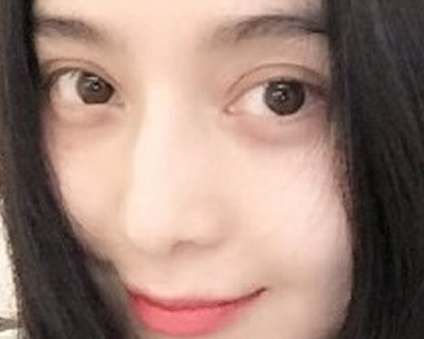 范爺親赴台灣為了它~皮秒雷射