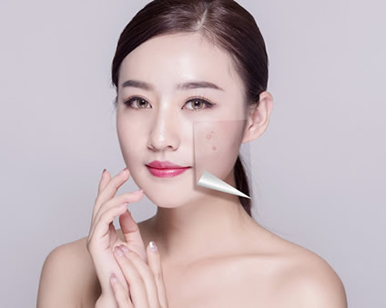 三個讓痘痘變嚴重的錯誤行為