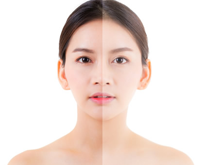 【採訪文】4D埋線拉提實做心得